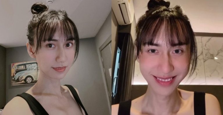 Lynk Lee khoe giọng hát sau khi cắt yết hầu, còn có câu quote tình yêu “nghỉ cho phẻ” hài hước