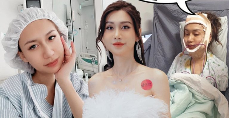 Nhan sắc của Lynk Lee 3 năm sau ngày công khai 8 lần phẫu thuật